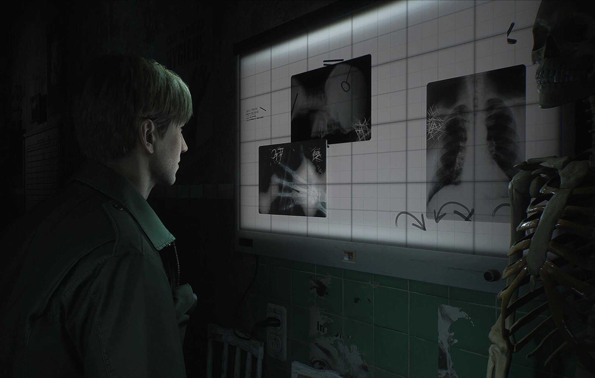 silent hill 2